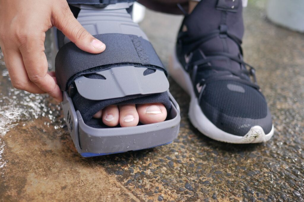 Overpronation and Gait Correction